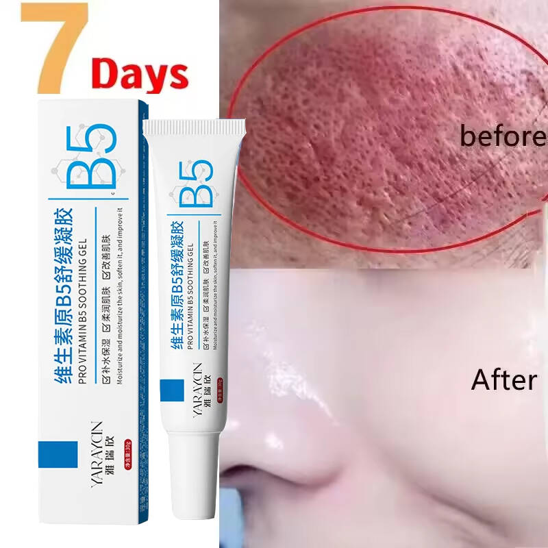 ครีมซ่อมแซมรอยแดงบนใบหน้าปรับป - Beauty Makeup Cream บทวิจารณ์และราคา