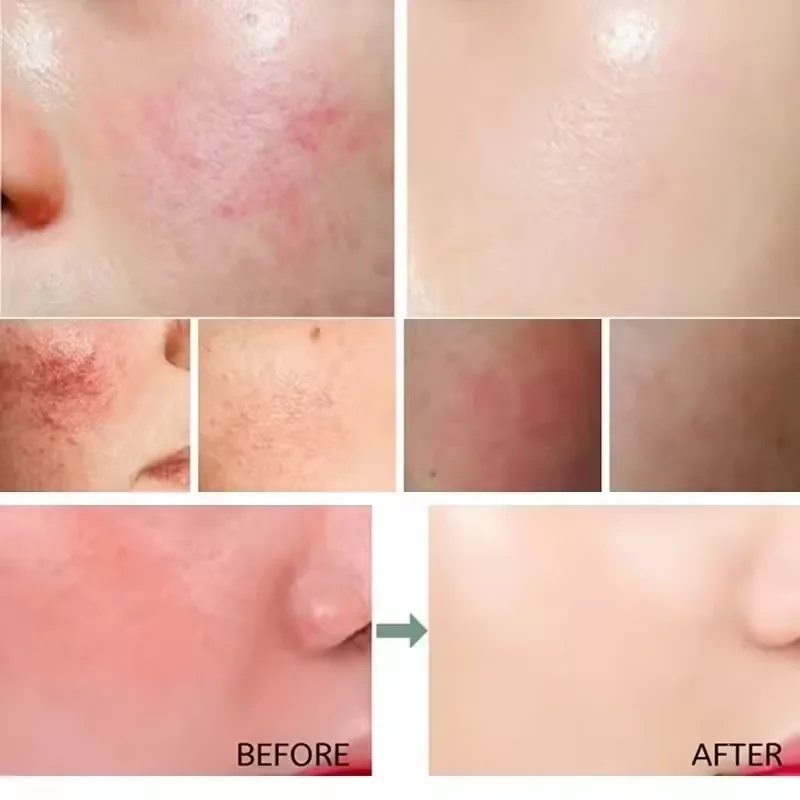 ครีมซ่อมแซมรอยแดงบนใบหน้าปรับป - Beauty Makeup Cream บทวิจารณ์และราคา